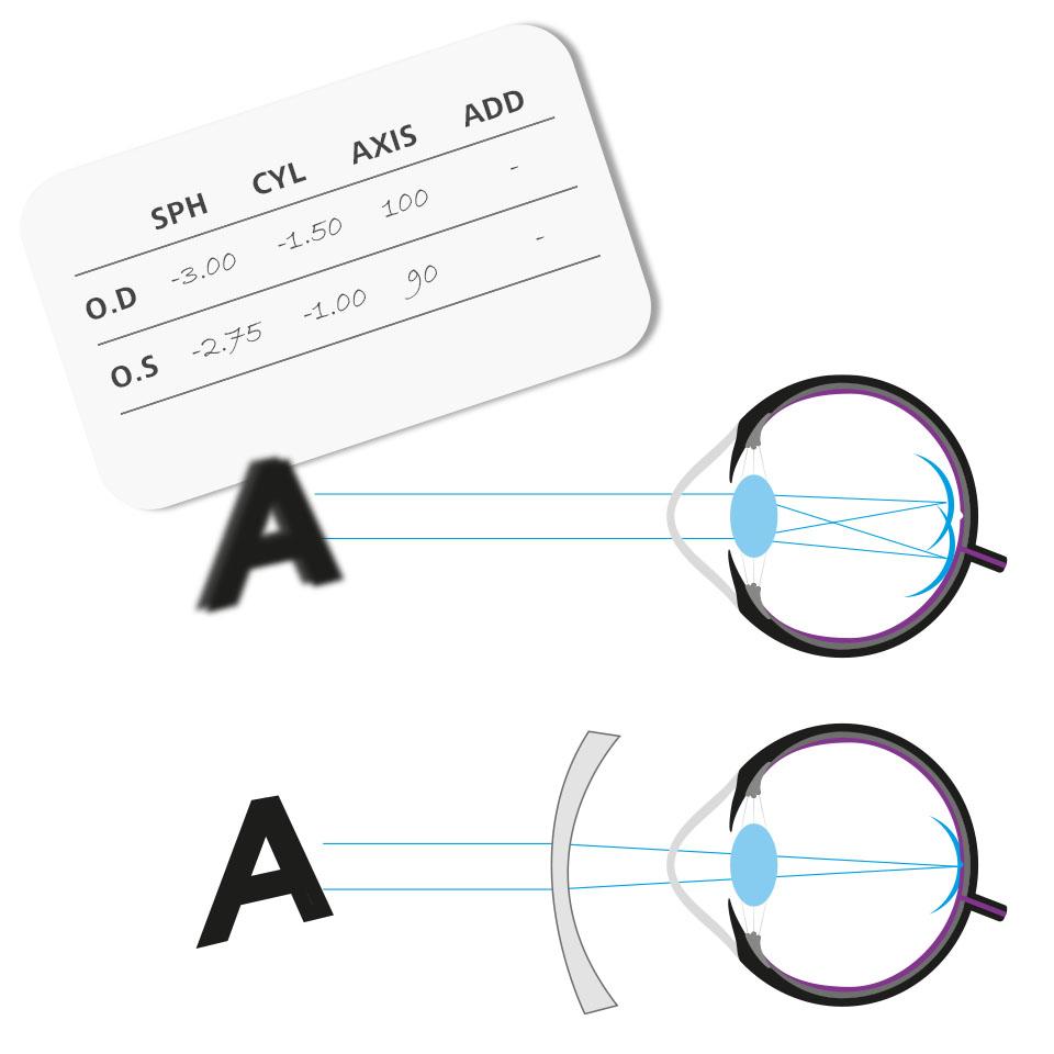 Silmälasimääräys, jossa on numeroita CYL- ja AXIS-sarakkeessa